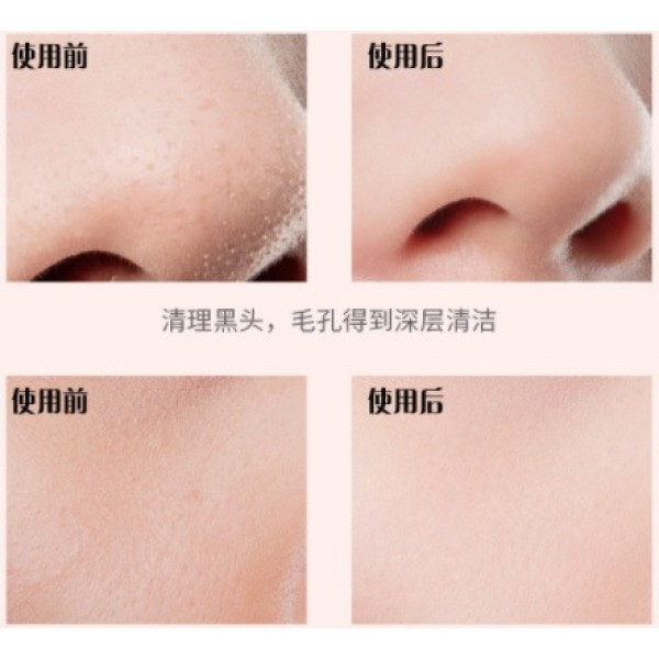 Ультразвуковой скрабер для чистки лица Maierda A-188 Винница - изображение 5