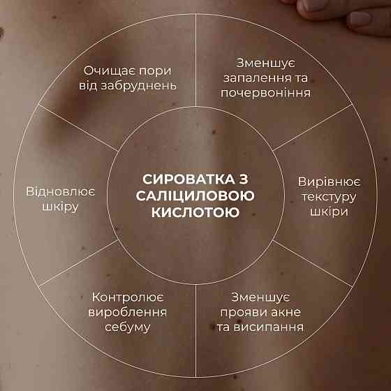 Набор против воспалений и высыпаний на теле Hillary Back & Body Acne Care Set Киев