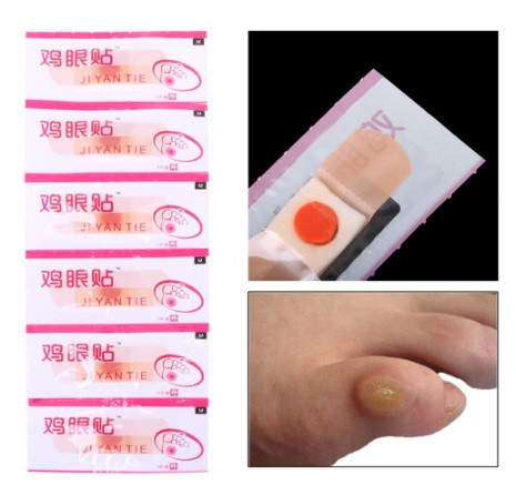 Пластырь мозольный - 6шт. (телесного цвета, для удаления сухих мозолей) Киев - изображение 1