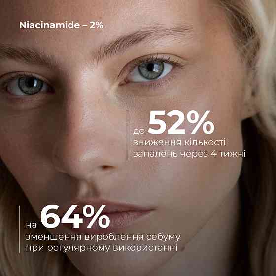 Набор для уменьшения жирности и воспалений с ниацинамидом Hillary Anti-Blemish Niacinamide Set Киев