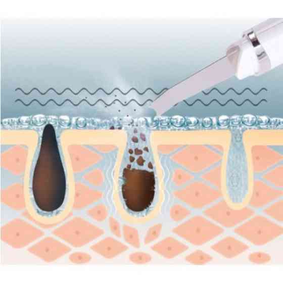 Ультразвуковой скрабер для чистки лица Maierda A-188 Киев