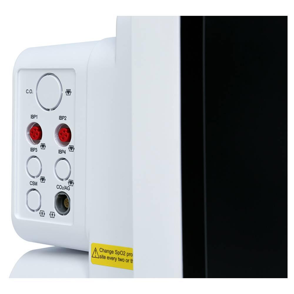 Монітор пацієнта з сенсорним екраном і ETCO2 "15 K15 Creative Medical Дніпро - фото 4