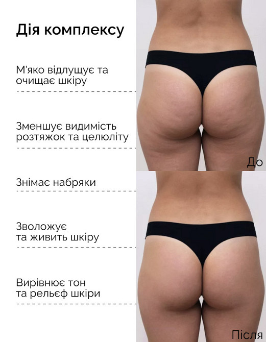 Двойной антицеллюлитный набор для тела с теплым обертыванием Reclaire cosmetics Киев - изображение 2