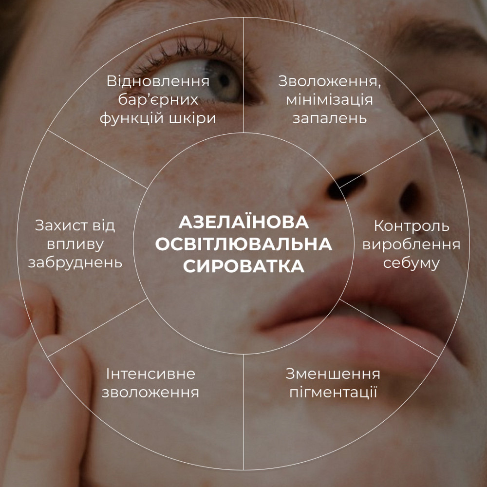 Набір для зволоження та освітлення тону шкіри обличчя з азелаїновою кислотою Hillary Hydration & Azelaic Киев - изображение 6