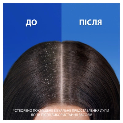 Шампунь Head & Shoulders 2 в 1 Против перхоти Свежесть ментола 625 мл (8700216305372) Винница - изображение 3