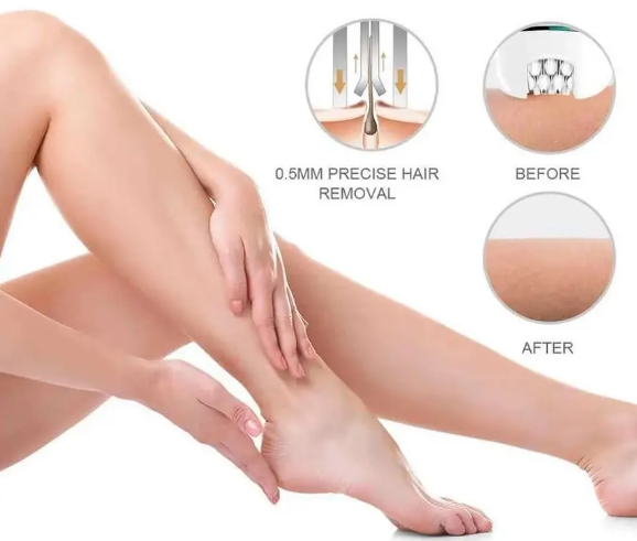 Акумуляторний Епілятор VGR V-700 4в1, 3 голівки для гоління, час роботи 50 хвилин (7998) Одеса - фото 8