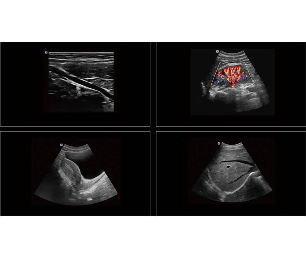 Ультразвукова діагностична система стаціонарна високого класу +2 датчики Danus 10 Focus & Fusion Дніпро - фото 7
