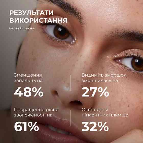 Набір проти тьмяності, постакне та пігментації Hillary Anti-Dullness & Post-Acne Brightening Set Киев