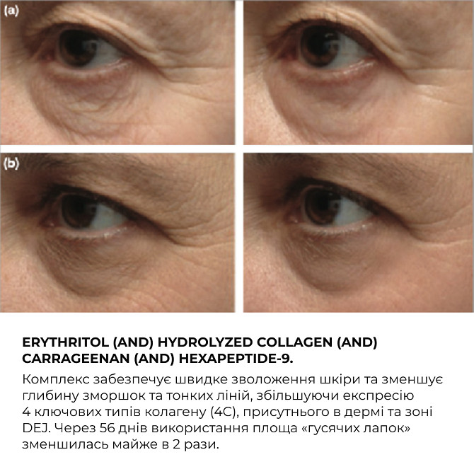 Крем для комплексного омолодження шкіри навколо очей ReNuAge Time Warp Eye Cream Hillary 15 мл Вінниця - фото 10