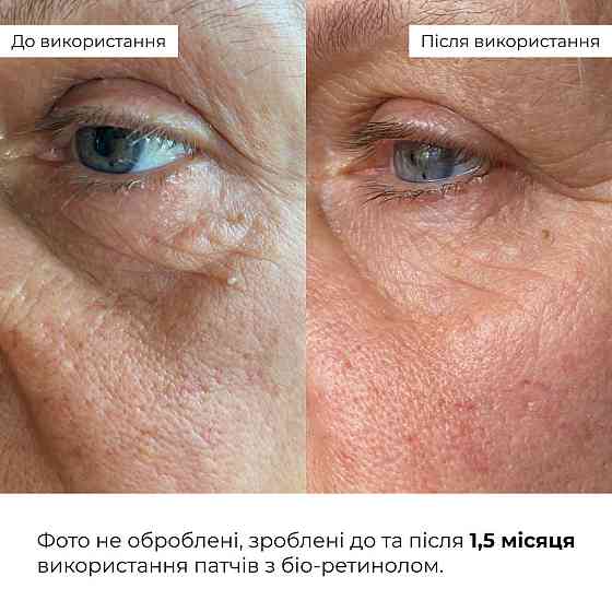 Набор для омоложения и коррекции возрастных изменений Hillary Deep Anti-Aging & Wrinkle Correction Set Киев