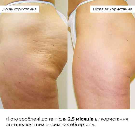 Курс Антицелюлітних ензимних обгортань Hillary Anti-cellulite Bandage Zymo Cell (6 уп,) Київ