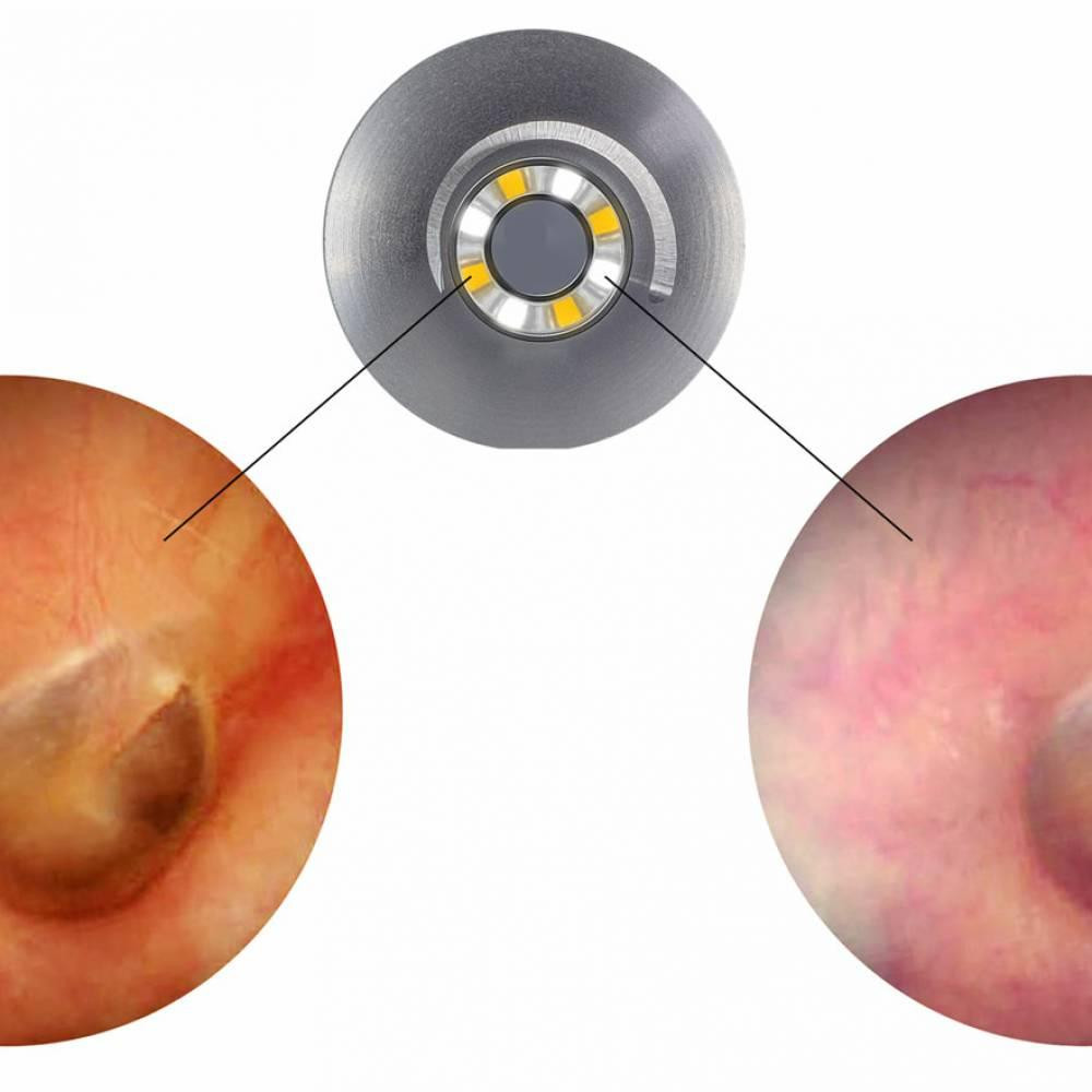 Отоскоп LuxaScope Auris CCT LED 2.5В, білий, Luxamed Дніпро - фото 2