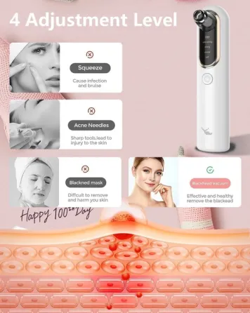 Вакуумный очиститель пор Yccu Y002 для лица, 4 режима, 4 насадки, USB, удаление черных точек Киев