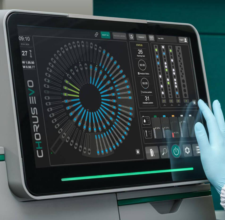 Аналізатор імуноферментний автоматичний Chorus EVO Diesse Дніпро - фото 2