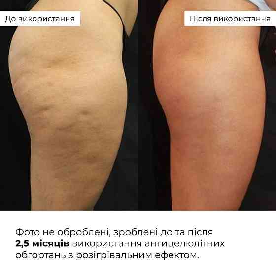 Антицелюлітні обгортання з розігрівальним ефектом Hillary Anti-cellulite Bandage Warming Effect Київ