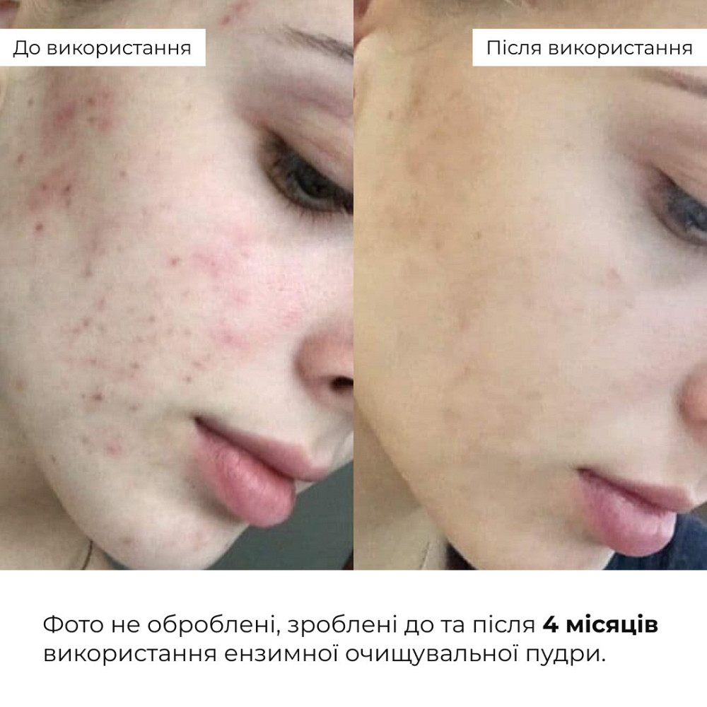 Набор глубокого увлажнения и восстановления для нормальной кожи лица Hillary for Normal Facial Skin Киев - изображение 14