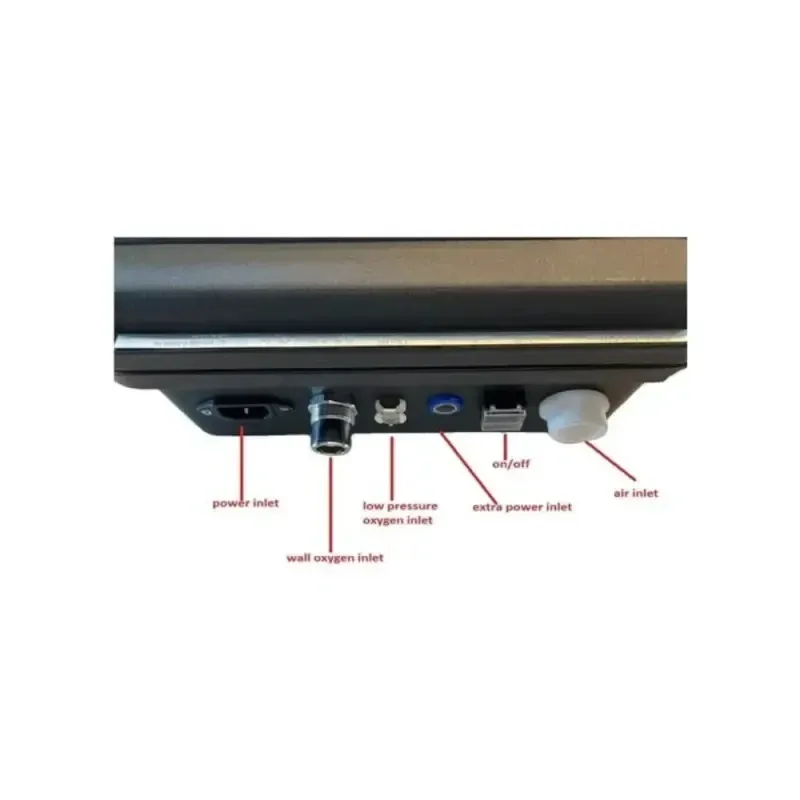 Апарат штучної вентиляції легень (ШВЛ) Foras Sahra SE-01 Дніпро - фото 6