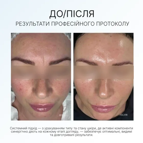 Набір енергія вітамину С Vitamin C Set AG Skin Дніпро