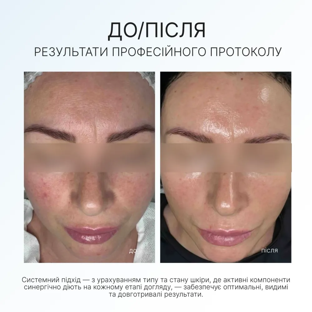 Набір енергія вітамину С Vitamin C Set AG Skin Дніпро - фото 5