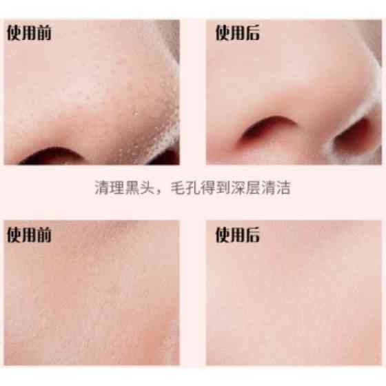 Ультразвуковой скрабер для чистки лица Maierda A-188 Киев