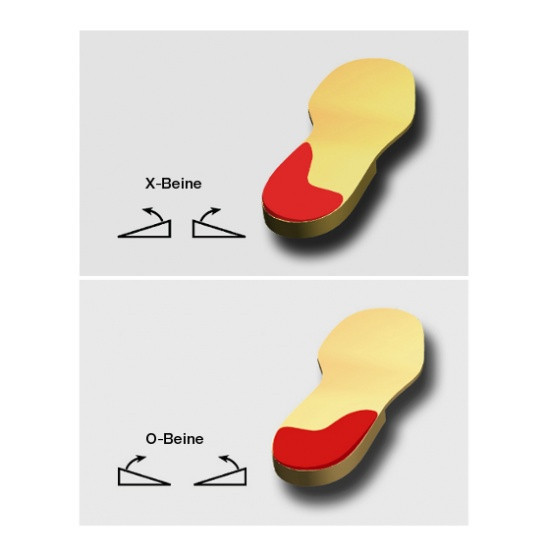 Жорсткий коригувальний підп'ятник Correct M Дніпро - фото 2