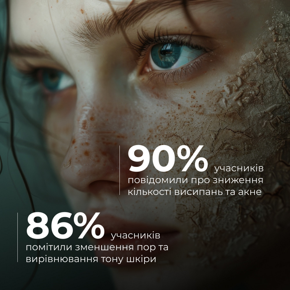 Глиняная детокс-маска для проблемной кожи лица Anti-Acne & Detox Clay Mask Hillary 90 мл Киев - изображение 19