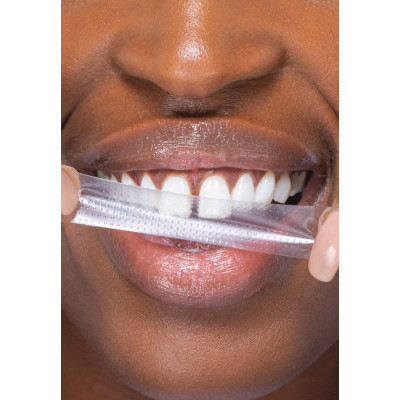 Засіб для відбілювання зубів SmileKit PAP+ Смужки 28 шт. (5.1510) Вінниця - фото 6