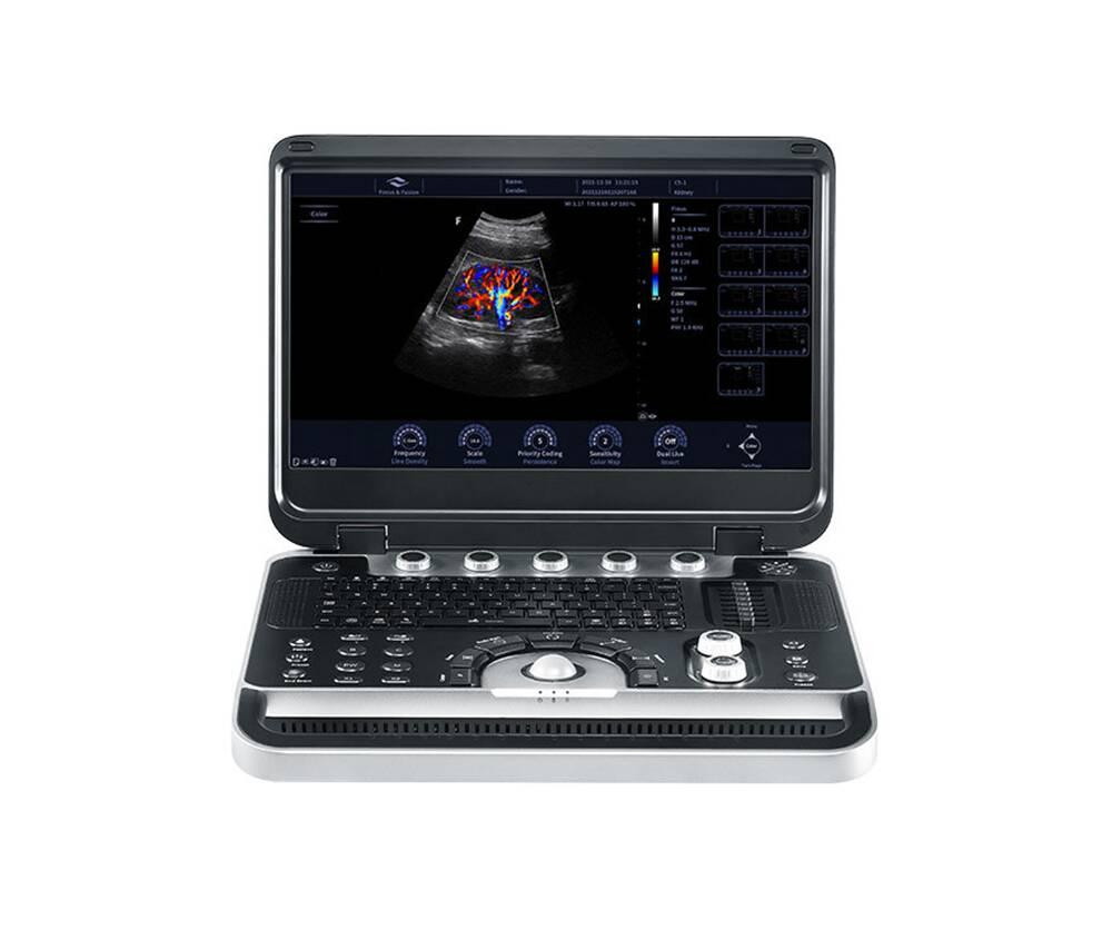 Ультразвукова діагностична система портативна високого класу +2 датчики Finus 50 Focus & Fusion Дніпро - фото 1