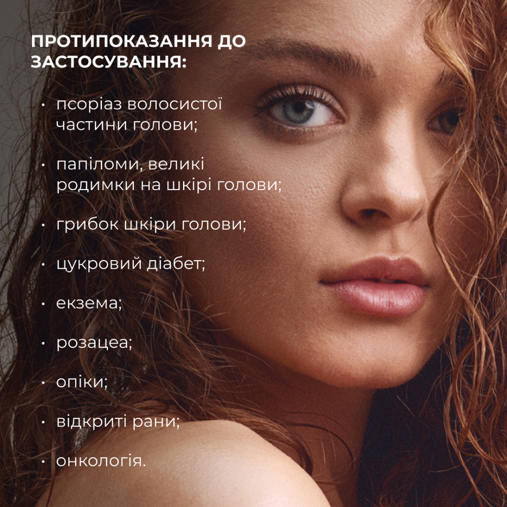 Мезороллер для кожи головы Hillary Киев - изображение 17