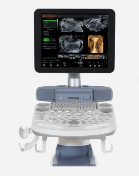 Ультразвуковий апарат (УЗД) Voluson™ P8 Дніпро - фото 4