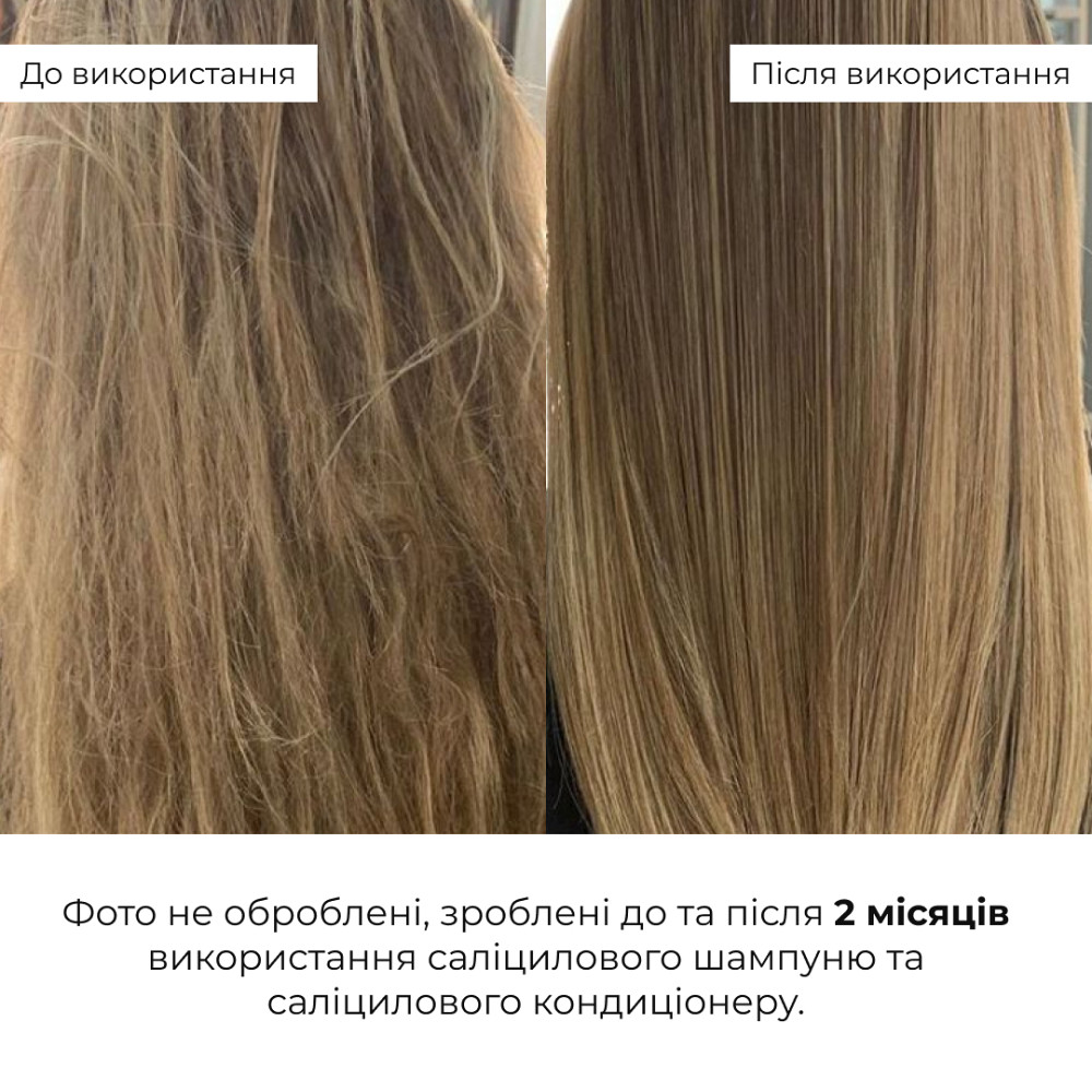 Саліциловий кондиціонер для відновлення волосся Salicylic Hair Reset Conditioner Hillary 400 мл Київ - фото 2