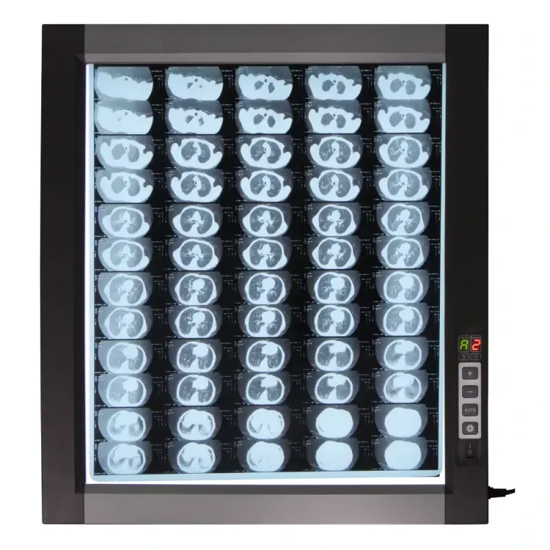 Світлодіодний медичний негатоскоп WL-1D Дніпро - фото 1