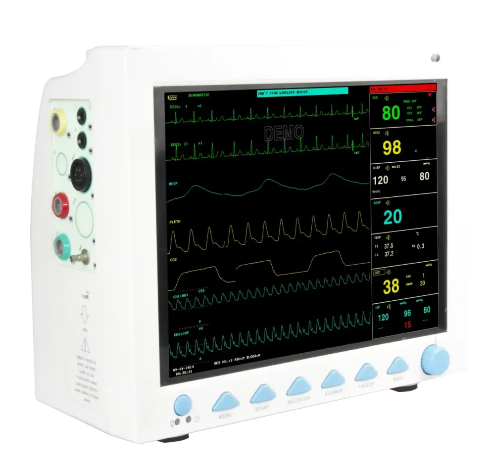 Монітор пацієнта Heaco G3D Дніпро - фото 3