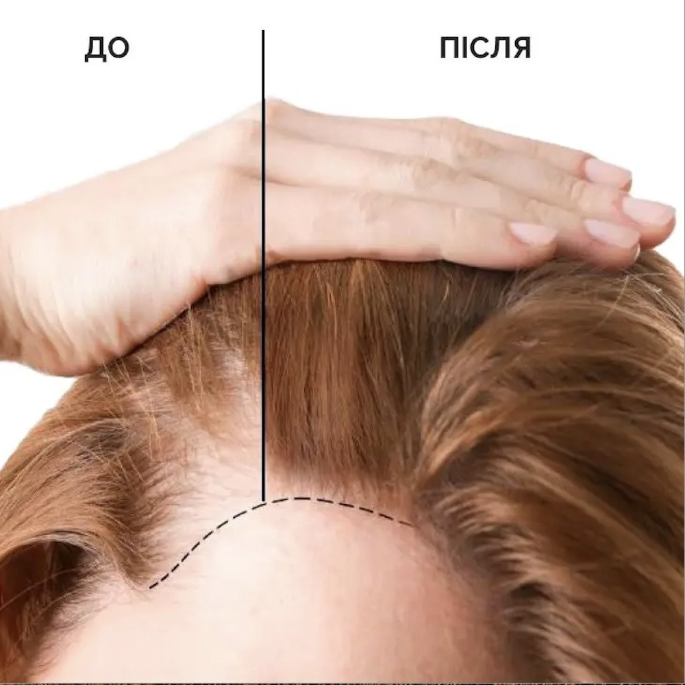 Сыворотка-стимулятор для роста и против выпадения волос Reclaire cosmetics 100 мл Киев - изображение 9