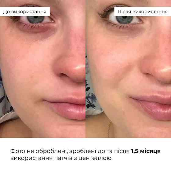 Набір із центеллою для заспокоєння та відновлення шкіри Hillary Centella Soothing & Recovery Set Київ