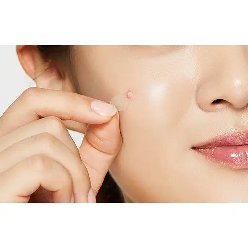 Пластырь для локального устранения прыщей Clear Fit Master Patch Cosrx 18х18 Киев - изображение 3