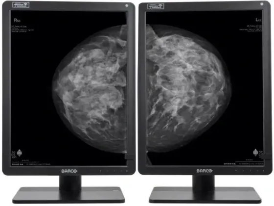 Монитор  medyczny Barco Nio Grey 5MP MDNG‑6221 SPEF Киев