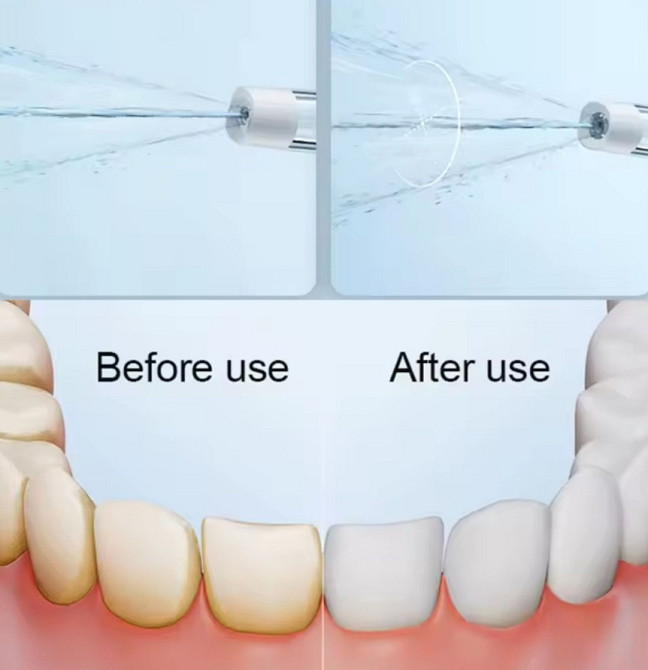 Портативный ирригатор XIAOMI MIJIA F300 Оригинальный. Харьков - изображение 1