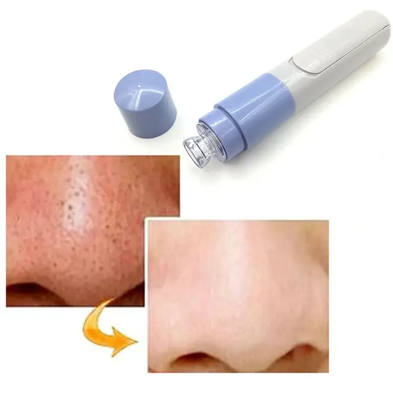 Вакуумный очиститель пор Pore Cleaner Коломия - фото 2