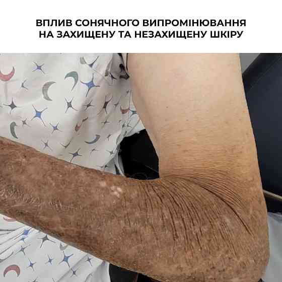 Набор для защиты кожи лица и тела от фотостарения SPF 50+ Hillary Face & Body Photoaging Defense Set Киев
