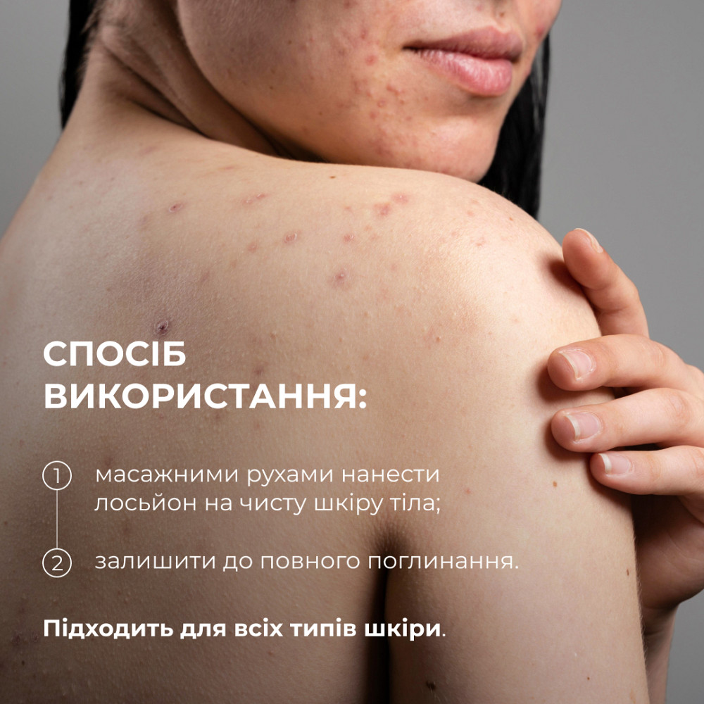 Лосьйон-детокс для проблемної шкіри з саліциловою кислотою Anti-Acne Salicylic Body Lotion Hillary 150 мл Київ - фото 7