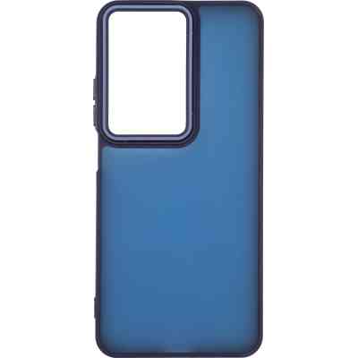 Чохол до мобільного телефона Armorstandart Frame Realme C75 4G / C75x 4G Blue (ARM86094) Вінниця
