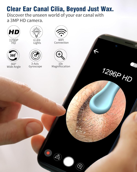 Інструмент для видалення вушної сірки Kekoy Луцк - изображение 3