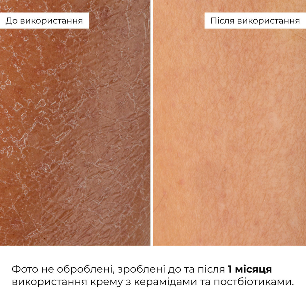 Набор для восстановления и освещения чувствительной кожи Hillary Sensitive Skin Recovery & Glow Set Киев - изображение 18