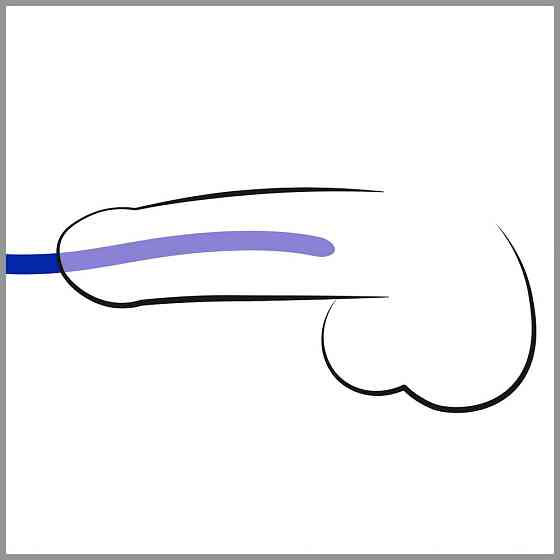 Стимулятори уретри Silikon Dilator Set Sex Aura Київ
