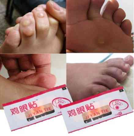 Пластырь мозольный - 6шт. (телесного цвета, для удаления сухих мозолей) Киев