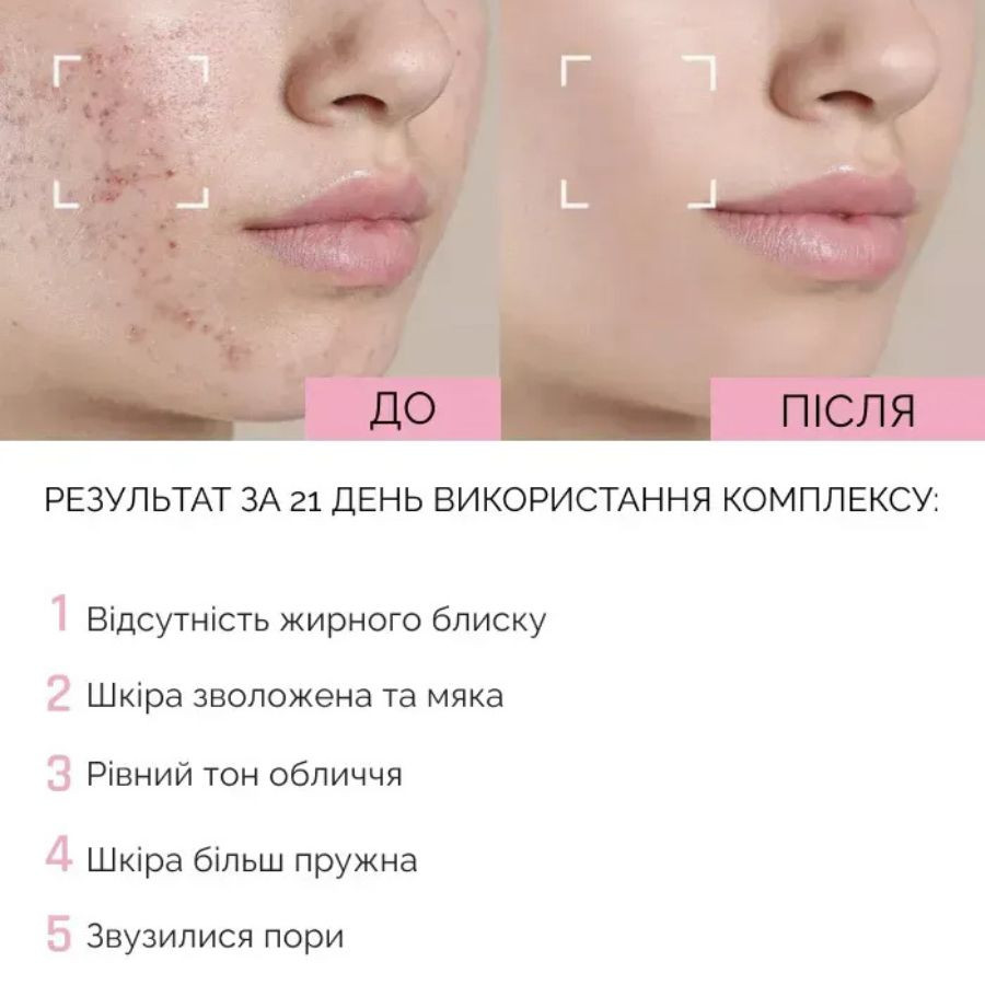Восстанавливающая сыворотка для лица с ниацинамидом и гиалуроновой кислотой Reclaire cosmetics 30 мл Киев - изображение 8