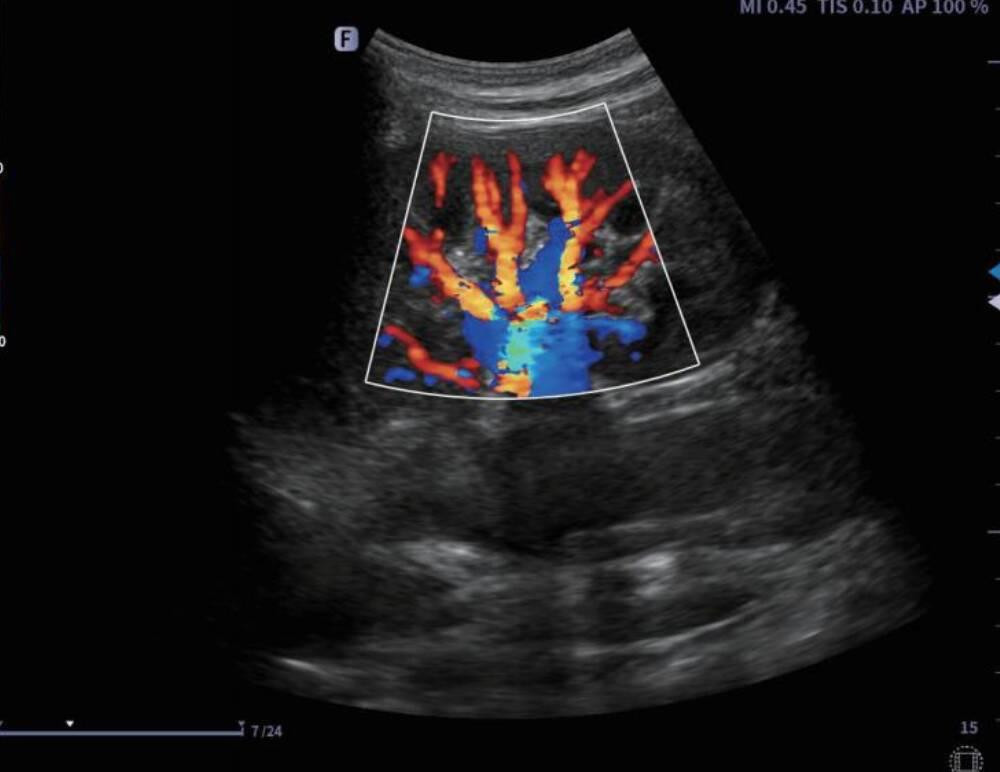 Ультразвукова діагностична система портативна Finus 45 Focus&Fusion Дніпро - фото 4
