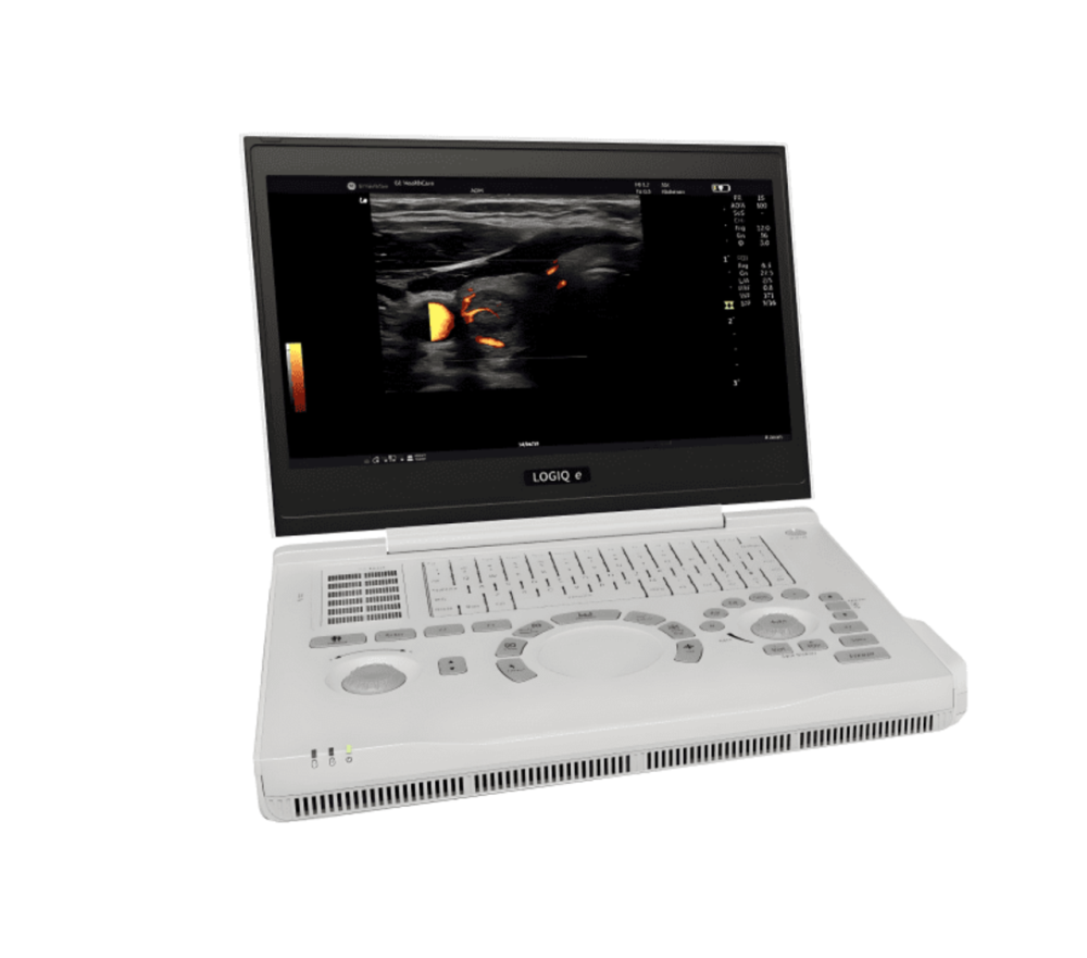 Портативний ультразвуковий апарат (УЗД) LOGIQ™ e Дніпро - фото 5