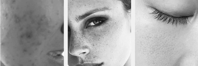 Світлодіодна лампа-дуга SD-075 для фотодинамічної терапії з парою (6 кольорів) Вінниця - фото 9